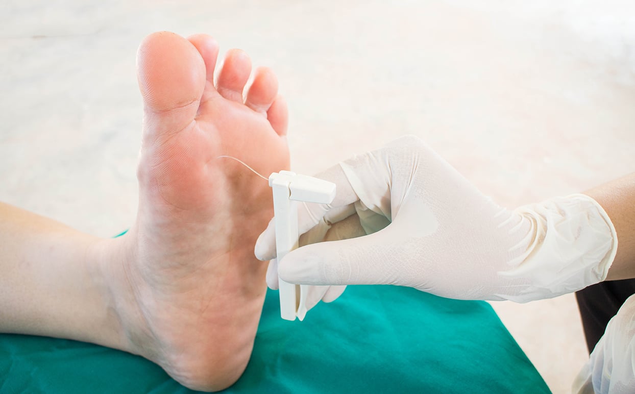 Traitement des pieds diabétiques